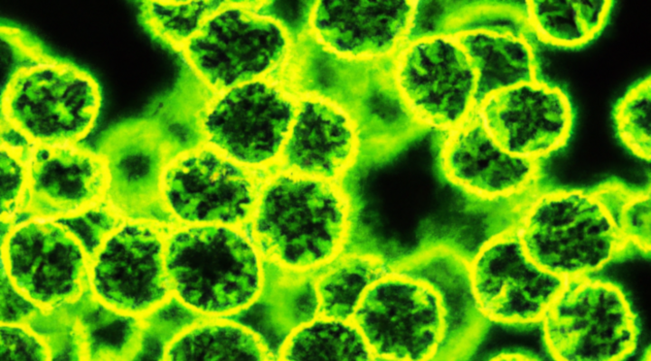 Fluoreszierende Nanopartikel