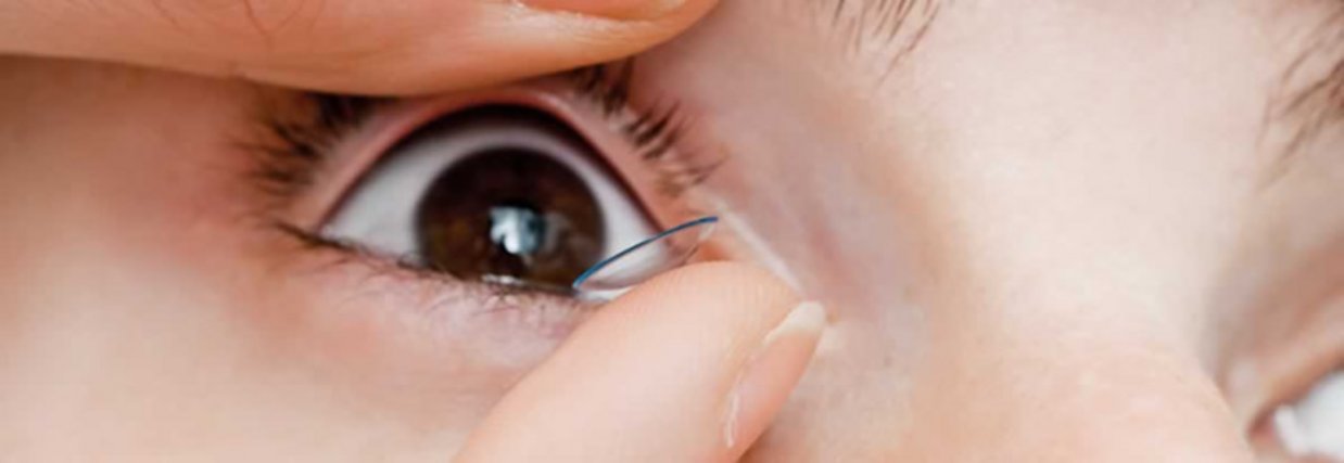 Contact lens fitting